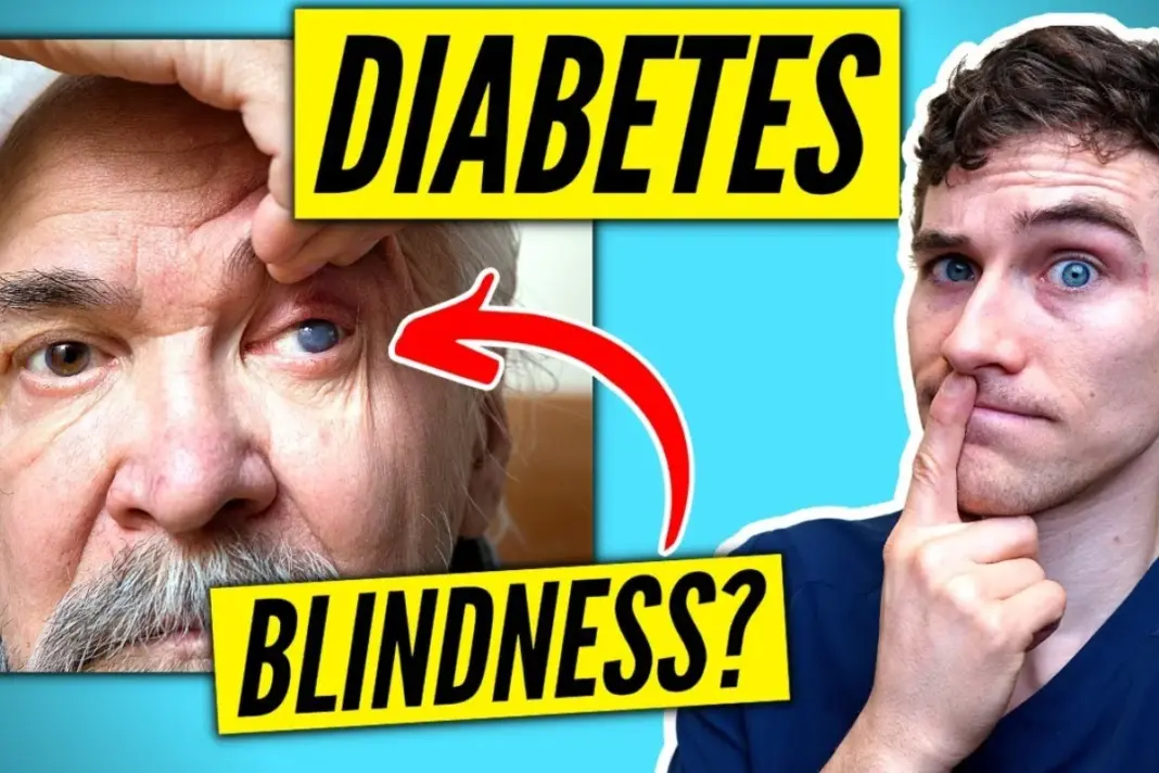 Uncontrolled Diabetes