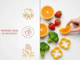 Vitamin C Deficiency Symptoms