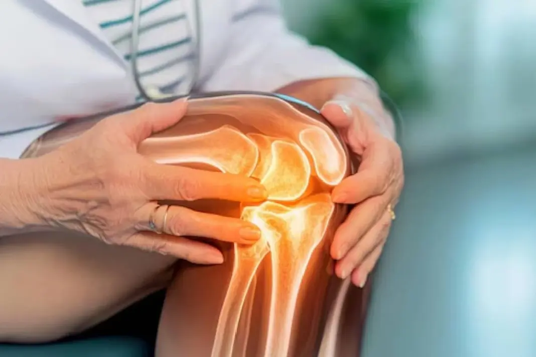 Vitamin D Deficiency