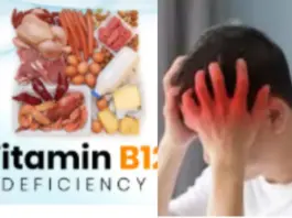 Vitamin B 12 Deficiency