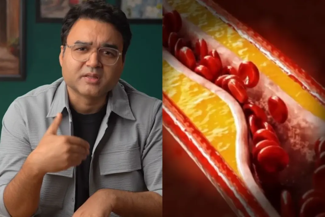 Heart Artery Plaque Reversal