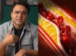 Heart Artery Plaque Reversal