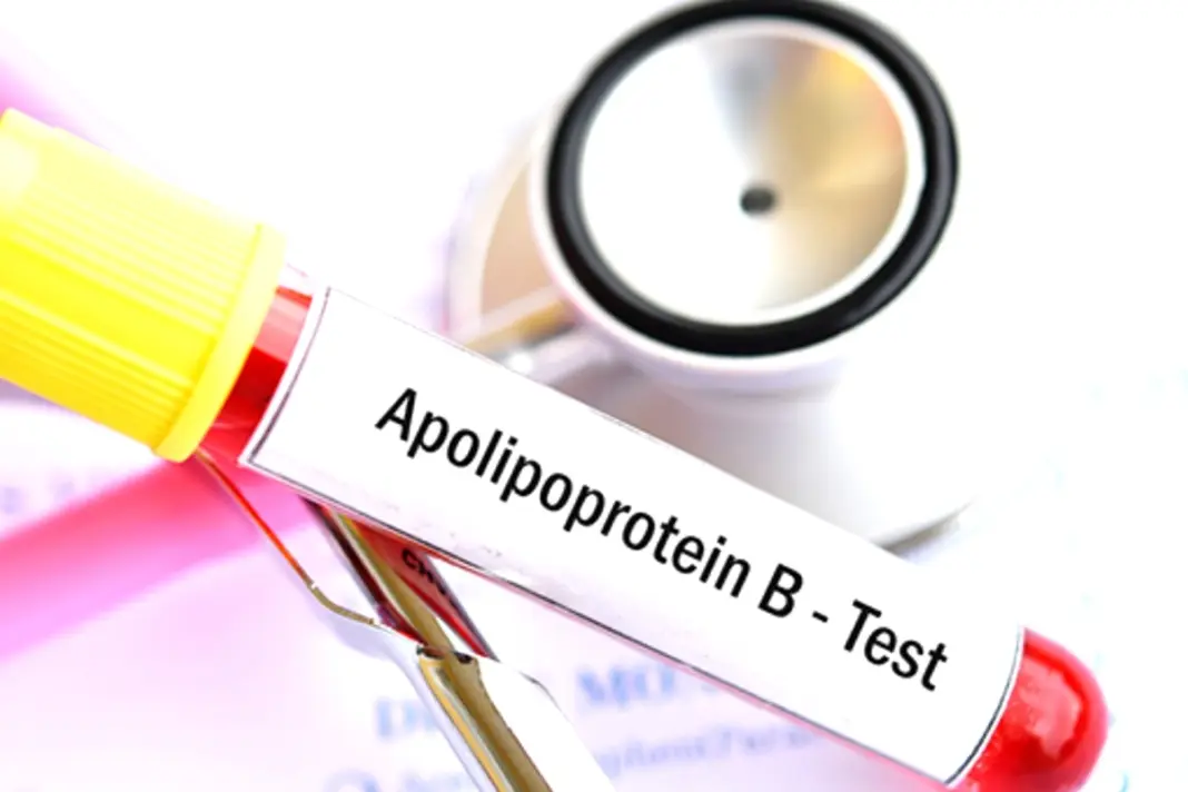 Apolipoprotein B ApoB Blood Test for Heart Danger