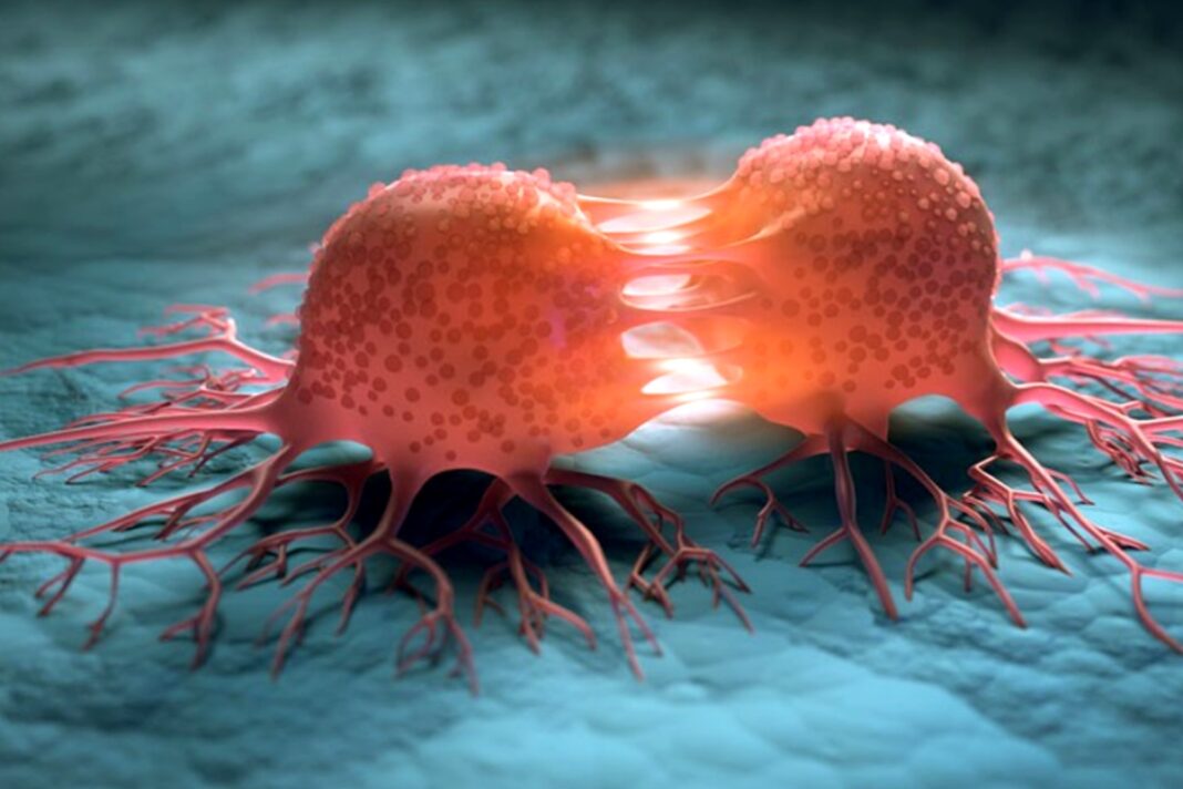 Can You Really Starve Cancer Cells To Death Doctor Breaks Silence On Viral Claim