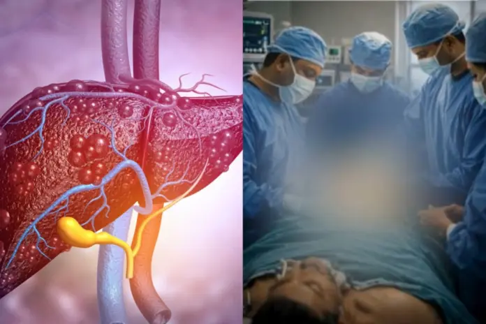 Liver Cirrhosis When Does It Hit The Point Of Irreversibility And Need Immediate Transplant