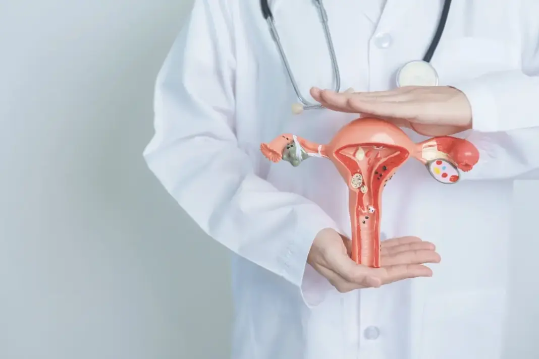 Cervical Cancer Screening