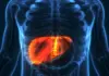 NAFLD: Is Your Daily Diet Destroying Your Liver Before 30? Nutrition Experts Sound the Alarm NAFLD