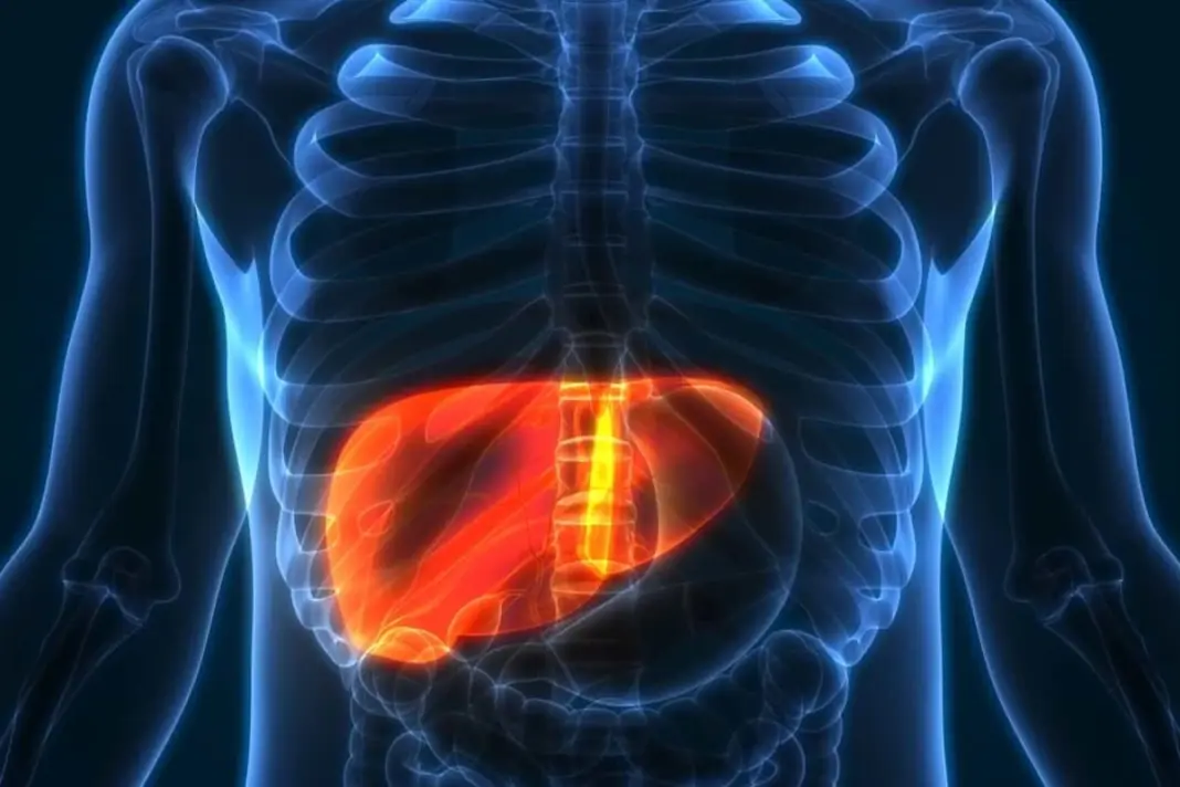 NAFLD